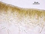 10 – Dettaglio dell’immagine precedente che evidenzia le tetrasporocisti
